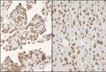 hnRNP-K Antibody in Immunohistochemistry (IHC)