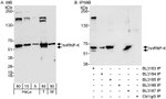 hnRNP-K Antibody in Western Blot (WB)