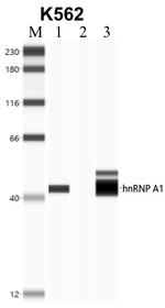 hnRNP A1 Antibody in Immunoprecipitation (IP)