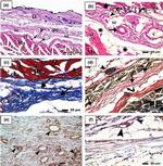 CD34 Antibody in Immunohistochemistry (IHC)