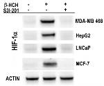 HIF1A Antibody in Western Blot (WB)