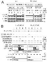 GST Tag Antibody in Western Blot (WB)