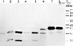 Penta-His Tag Antibody in Western Blot (WB)