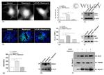 Bcl-2 Antibody in Western Blot (WB)