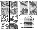 Filamin A alpha-2 Antibody in Western Blot (WB)