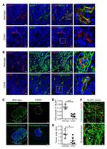 CD31 Antibody in Immunohistochemistry (IHC)