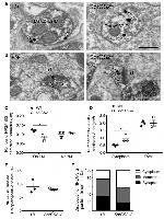 NMDAR2A Antibody in Immunomicroscopy (IM)