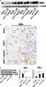 ROR gamma (t) Antibody in Western Blot (WB)