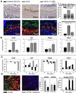 VDR Antibody in ChIP Assay (ChIP)