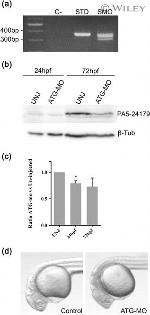 SEL1L Antibody in Western Blot (WB)