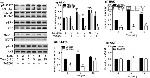 ALK Antibody in Western Blot (WB)