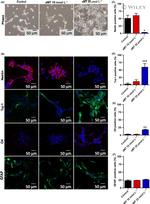 Nestin Antibody in Immunocytochemistry (ICC/IF)