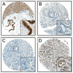 K-cadherin Antibody in Immunohistochemistry (Paraffin) (IHC (P))