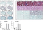 MMP2 Antibody in Immunohistochemistry (Paraffin) (IHC (P))