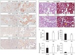 MMP2 Antibody in Immunohistochemistry (Paraffin) (IHC (P))