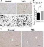 ICAM-1 Antibody in Immunohistochemistry (Frozen) (IHC (F))