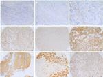 Claudin 4 Antibody in Immunohistochemistry (IHC)