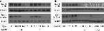 Phospho-EGFR (Tyr1068) Antibody in Western Blot (WB)