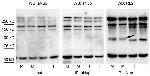 O-linked N-acetylglucosamine (O-GlcNAc) Antibody in Western Blot (WB)