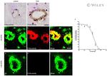 beta Amyloid Antibody in Immunohistochemistry (IHC)