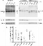 Lamin B1 Antibody in Western Blot (WB)