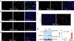 CD140b (PDGFRB) Antibody in Immunohistochemistry (IHC)