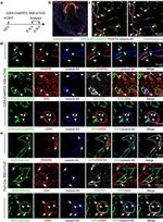 Alpha-Smooth Muscle Actin Antibody in Immunohistochemistry (IHC)