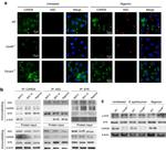 Syk Antibody in Western Blot, Immunoprecipitation (WB, IP)