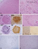 beta Amyloid (1-42) Antibody in Immunohistochemistry (Paraffin) (IHC (P))