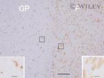 beta Amyloid (1-42) Antibody in Immunohistochemistry (Paraffin) (IHC (P))