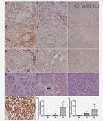 Cytokeratin 19 Antibody in Immunohistochemistry (IHC)