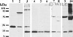 Connexin 26 Antibody in Western Blot (WB)