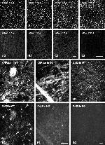 Connexin 32 Antibody in Immunohistochemistry (IHC)