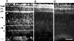 Connexin 26 Antibody in Immunohistochemistry (IHC)