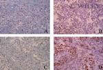 Aurora B Antibody in Immunohistochemistry (IHC)