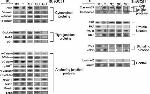 gamma Catenin Antibody in Immunoprecipitation (IP)