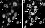 NMDAR2B Antibody in Immunohistochemistry (IHC)