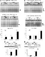 Phospho-STAT4 (Tyr693) Antibody in Western Blot (WB)