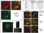 Coronin 1A Antibody in Immunocytochemistry (ICC/IF)