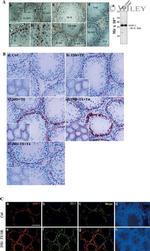 ZO-1 Antibody in Immunohistochemistry (Frozen) (IHC (F))