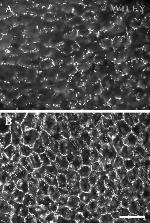 Connexin 26 Antibody in Immunohistochemistry (IHC)