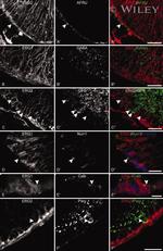 Parvalbumin Antibody in Immunohistochemistry (IHC)