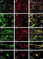 Connexin 29 Antibody in Immunohistochemistry (Frozen) (IHC (F))