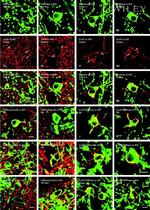 Connexin 43 Antibody in Immunohistochemistry (IHC)