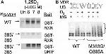 VDR Antibody in Western Blot (WB)