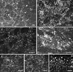 Connexin 26 Antibody in Immunohistochemistry (IHC)