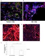 Ly-6G/Ly-6C Antibody in Immunohistochemistry (IHC)