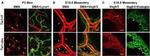 CD105 (Endoglin) Antibody in Immunohistochemistry (IHC)