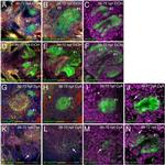 GFP Antibody in Immunohistochemistry (IHC)