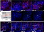 CD31 (PECAM-1) Antibody in Immunohistochemistry (IHC)